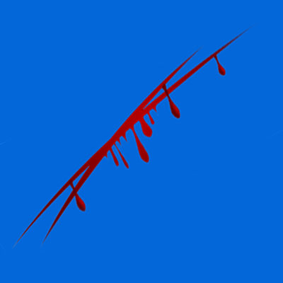 Scars